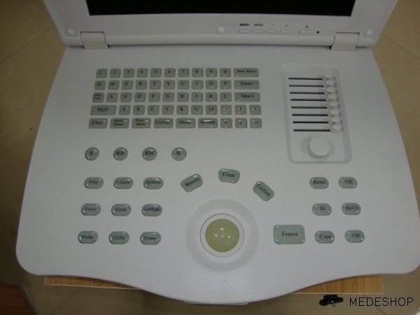 Full Digital Ultrasound Scanner 15+ConvexProbe  